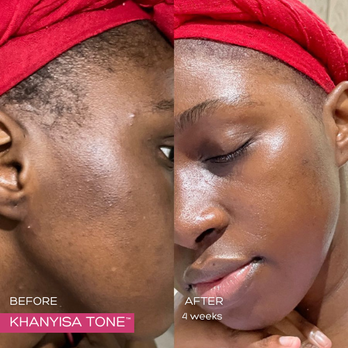 KHANYISA TONE™ – 6 Months Supply