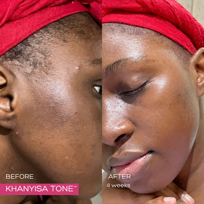 KHANYISA TONE™ – 6 Months Supply