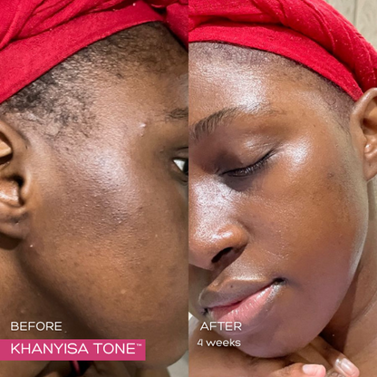 KHANYISA TONE™ – 2 Month Supply