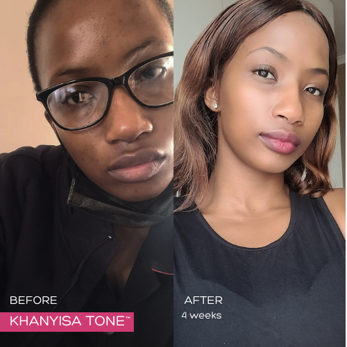 KHANYISA TONE™ – 1 Month Supply