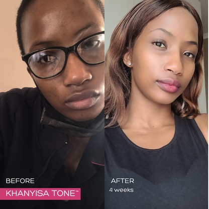 KHANYISA TONE™ – 6 Months Supply