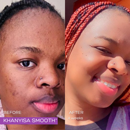 KHANYISA SMOOTH™ - 2 Month Supply