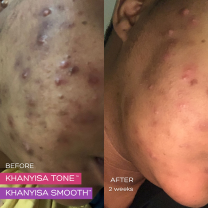 KHANYISA SMOOTH™ - 1 Month Supply