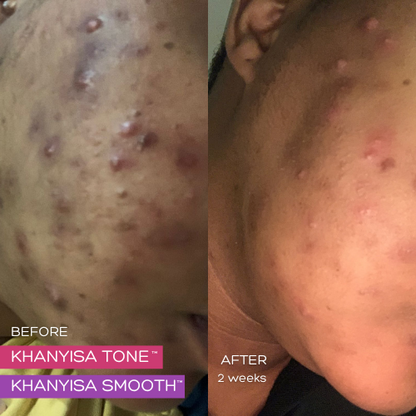 KHANYISA GLOW COMBO – 1 Month Supply