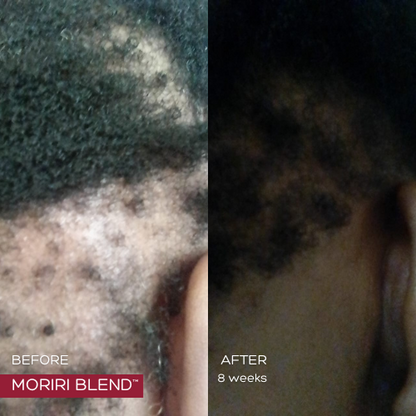 MORIRI BLEND™ - 2 Month Supply