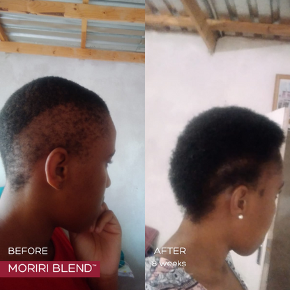 MORIRI BLEND™ - 3 Months Supply