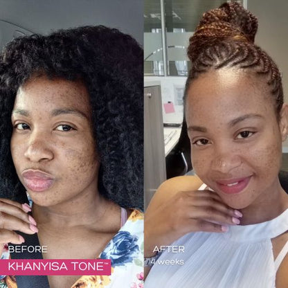 KHANYISA TONE™ – 1 Month Supply